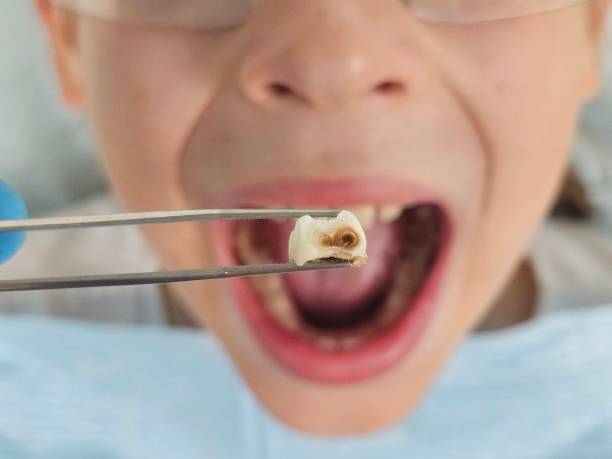 Best Tooth Pain Emergency Relief  in Broadview Heights, OH